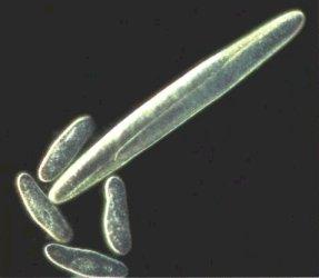Epulopiscium
